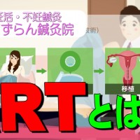 不妊症ARTとは？